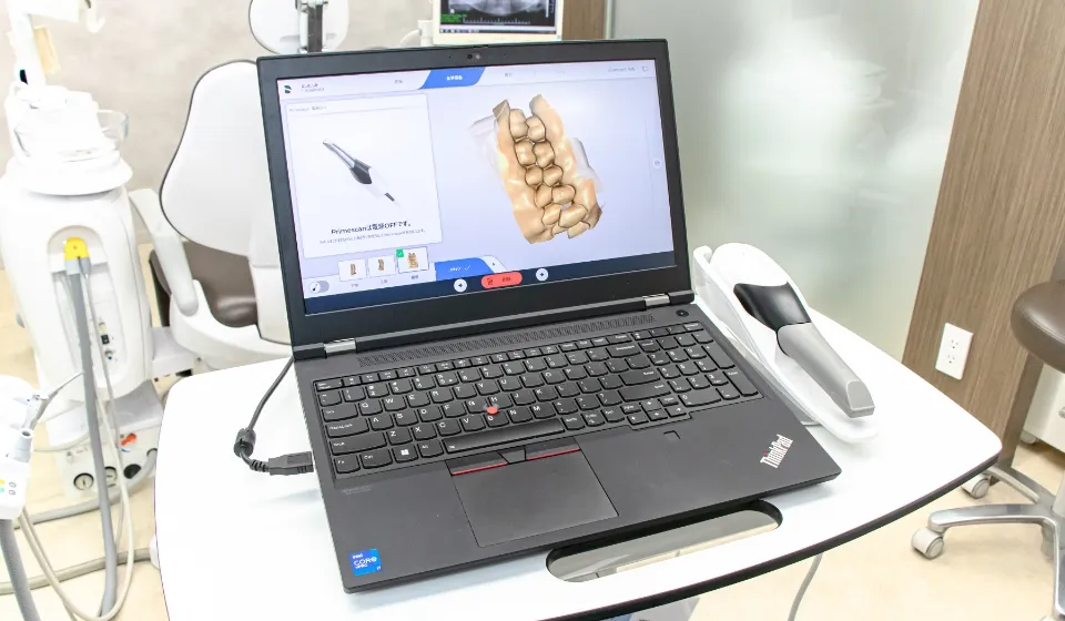 3D口腔内スキャナー