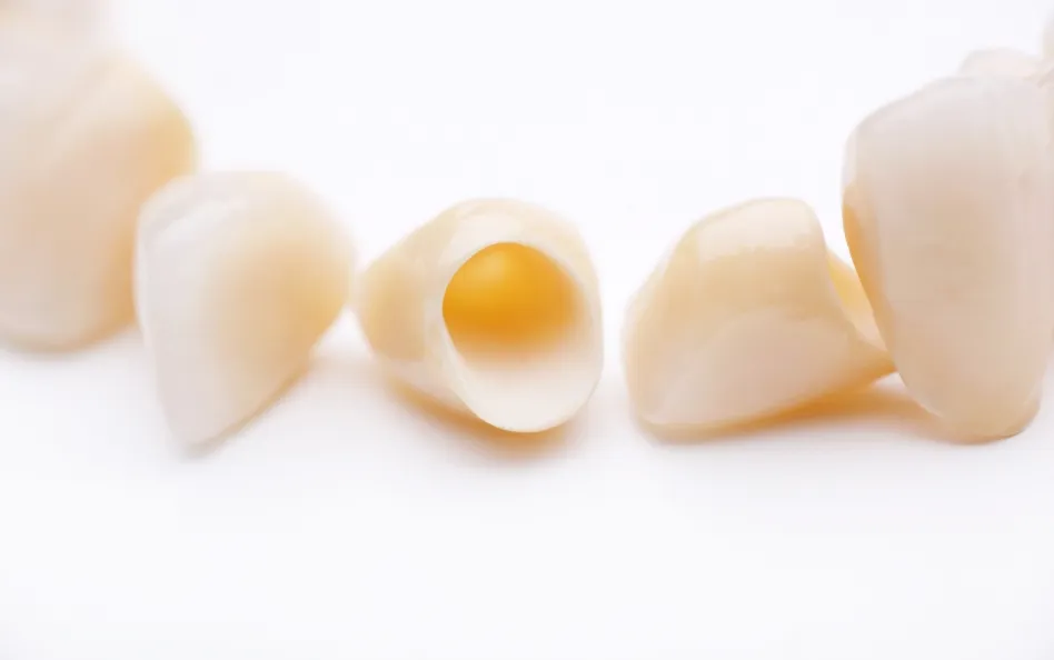 白くきれいな詰め物・被せ物をご希望の方