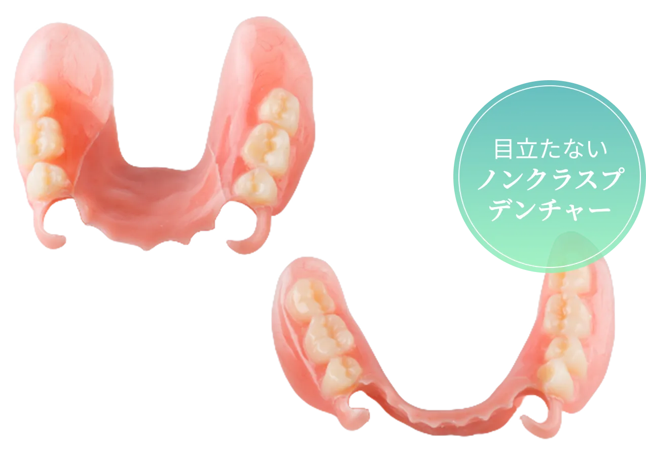 目立たないノンクラスプデンチャー
