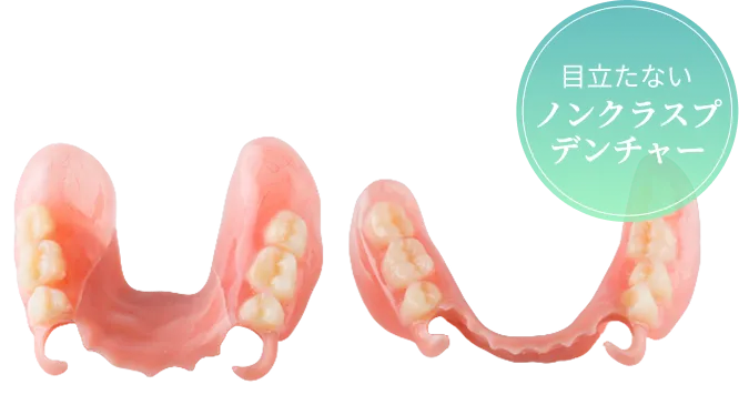 目立たないノンクラスプデンチャー