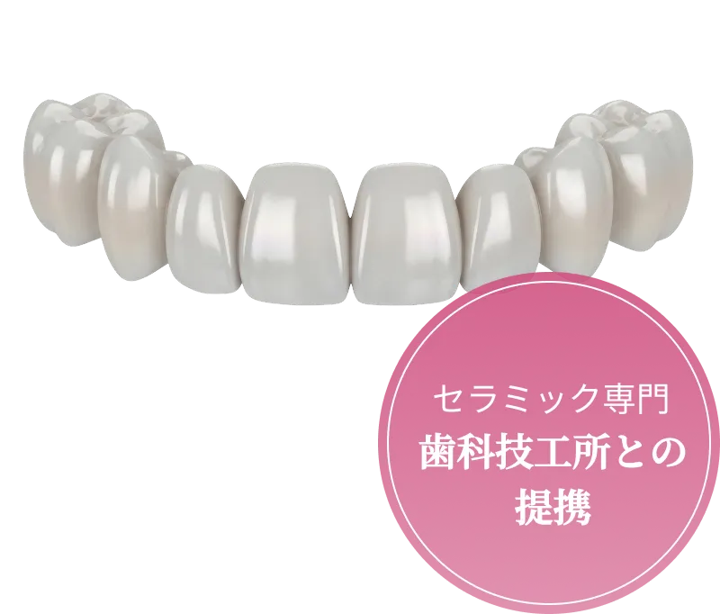 セラミック専門 歯科技工所との提携