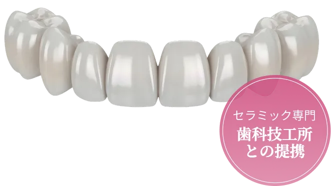 セラミック専門 歯科技工所との提携