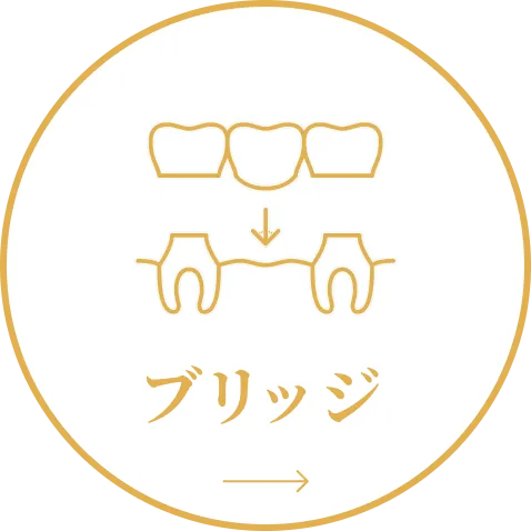 ブリッジ