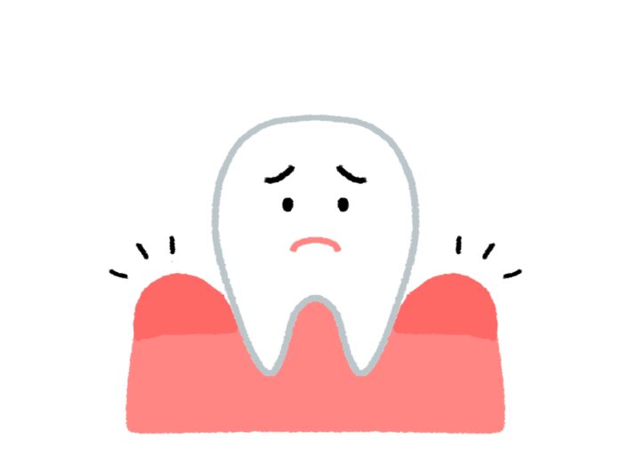 腫れた歯茎のイラスト