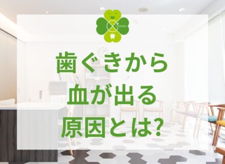 歯ぐきから血が出る原因とは?