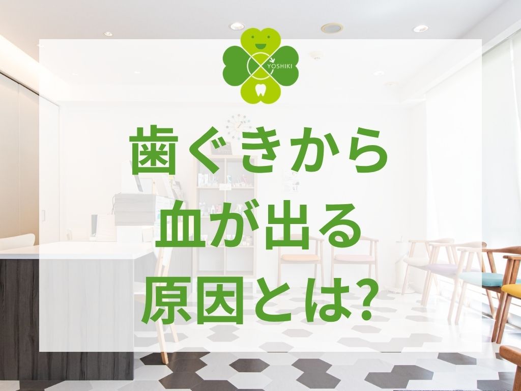 歯ぐきから血が出る原因とは?