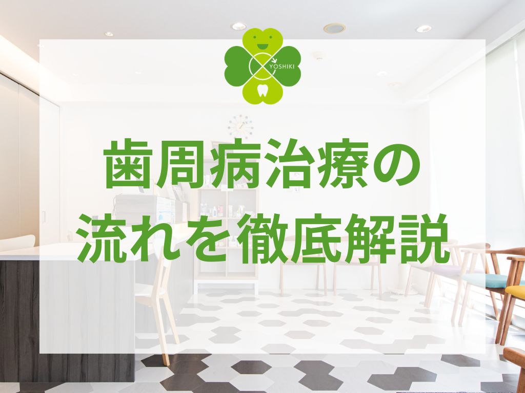 歯周病治療の流れを徹底解説